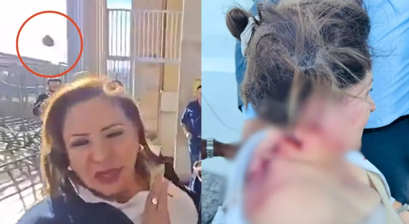 Kan donduran olay: Milletvekiline el yapımı patlayıcı fırlattılar!